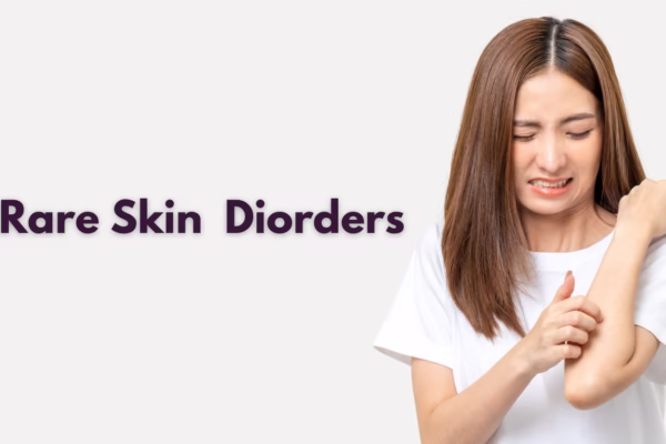 Rare Skin Disorders