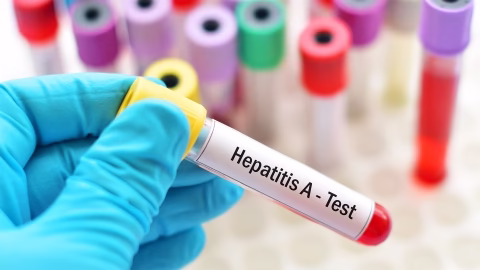 Hepatitis C