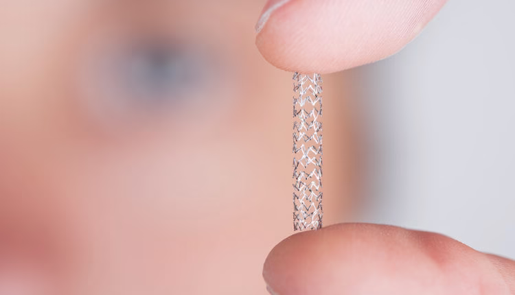 Cardiac Stent Prices to Rise by 2% Following Regulator’s Approval 1 Cardiac Stent