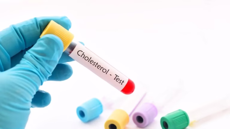 Cholesterol