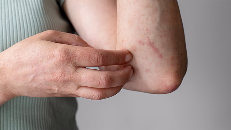 WHO Releases First Reports on Testing and Treatments for Fungal Infections 1 WHO