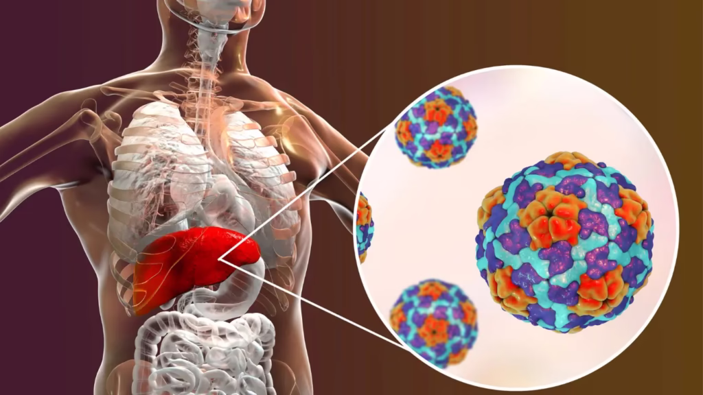 Hepatitis B medicines remain vastly underused: Lancet Study 1 Hepatitis B