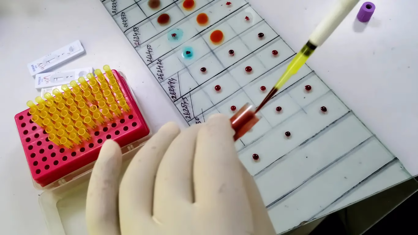 New Blood Group Antigen ‘CRIB’ Discovered in Bengaluru Woman 1 CRIB