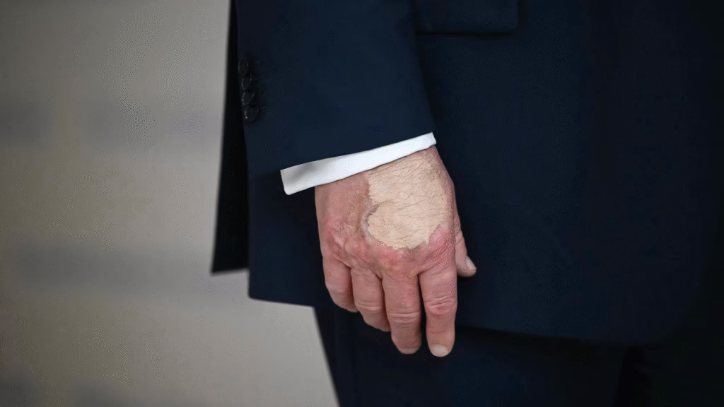What’s going on with Donald Trump’s hands? 1 image 40
