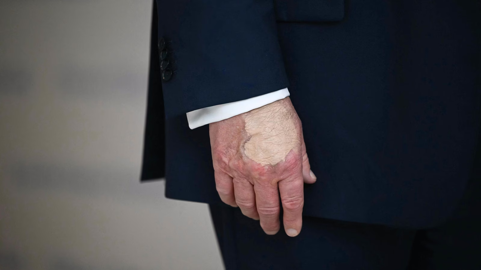 What’s going on with Donald Trump’s hands? 1 image 40
