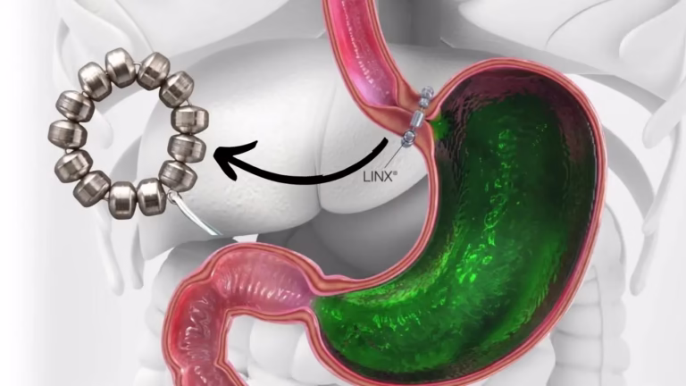 Maharashtra Pollution Control Board 80