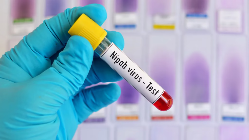 Nipah returned in West Bengal after 19 years: infects two more 1 Indian Industries Association 24