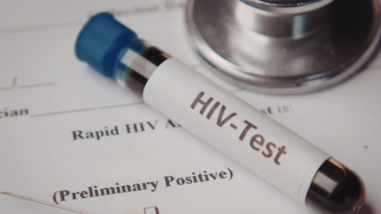 HIV