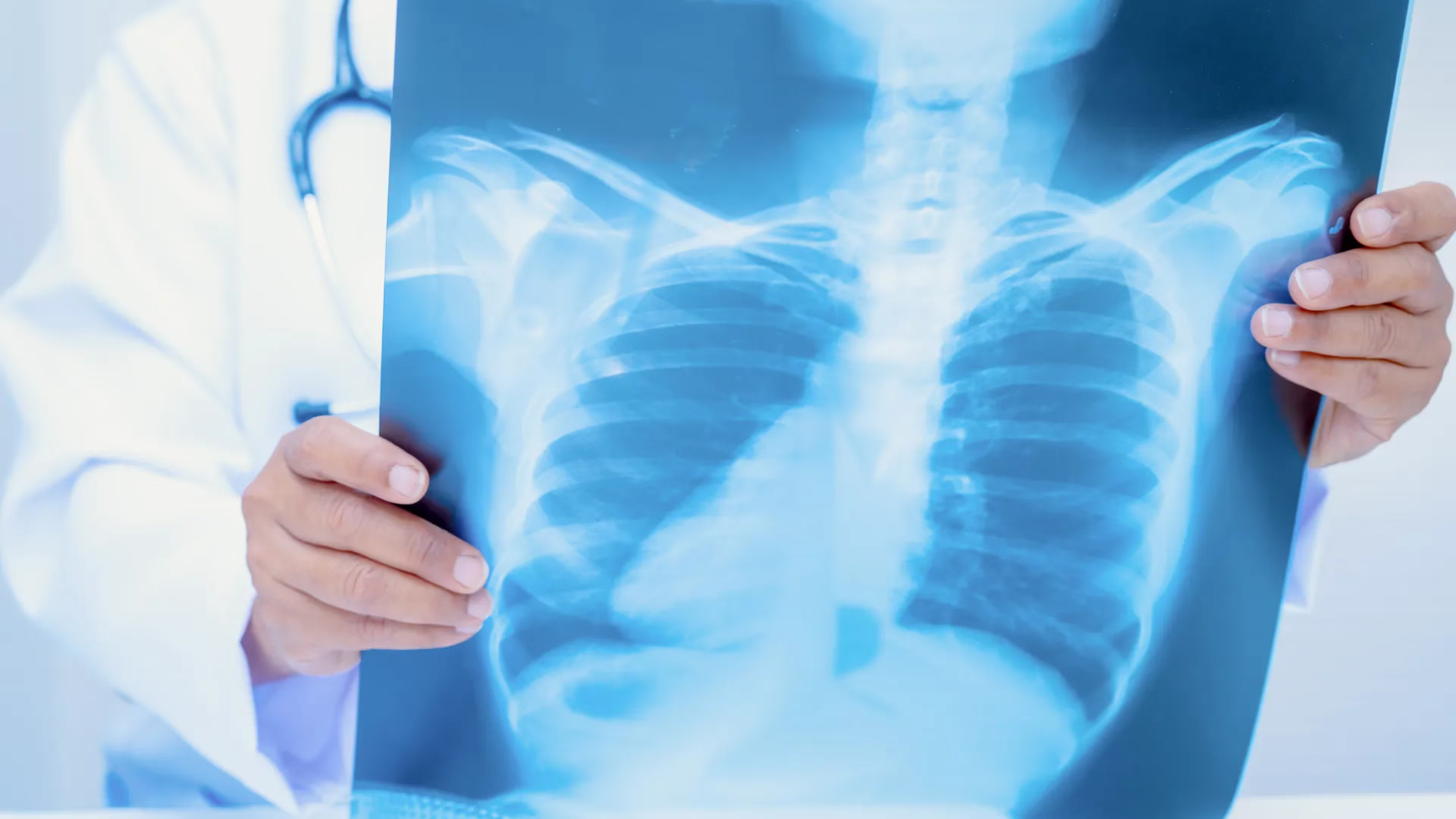 Haryana Rolls out AI-powered X-ray Devices in 2,111 Villages to Boost Early TB Detection 2 Untitled design 2 2