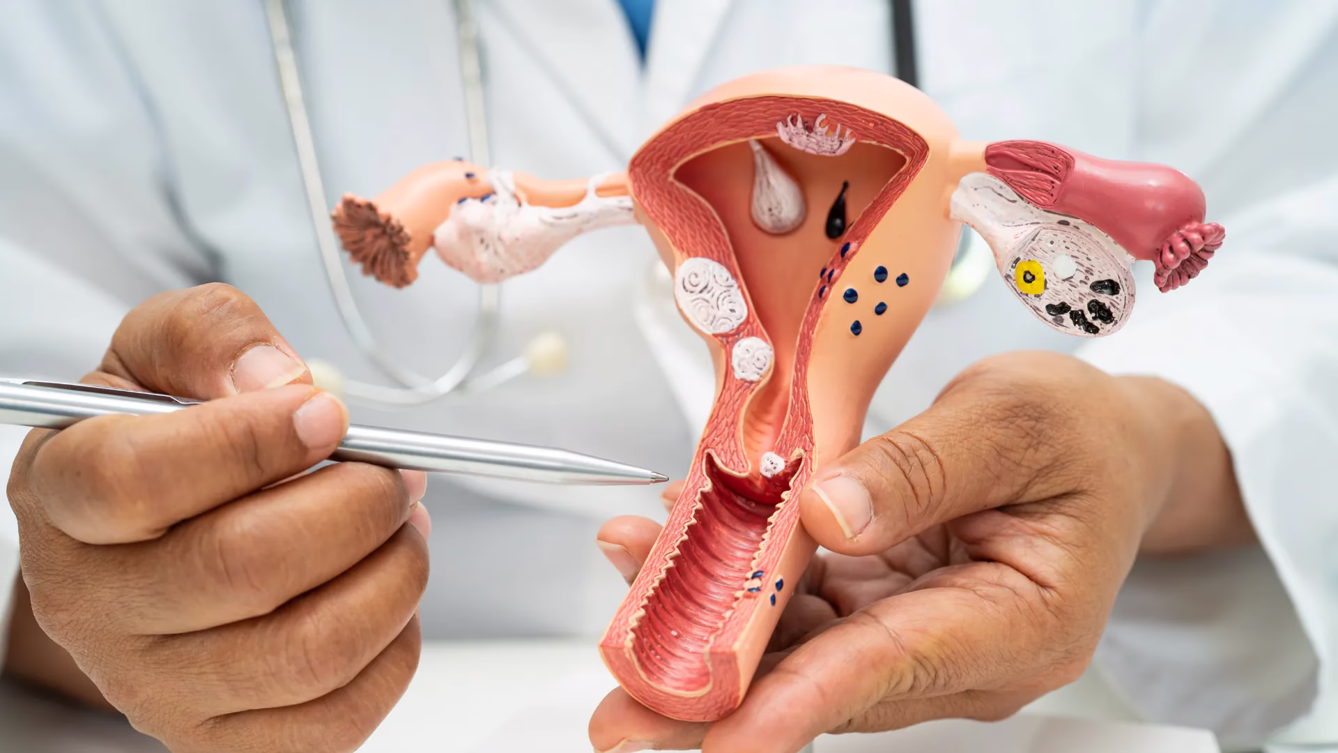 Kimberly-Clark India and UNICEF India Partner to Strengthen Menstrual and Maternal Health 3 Untitled design 3