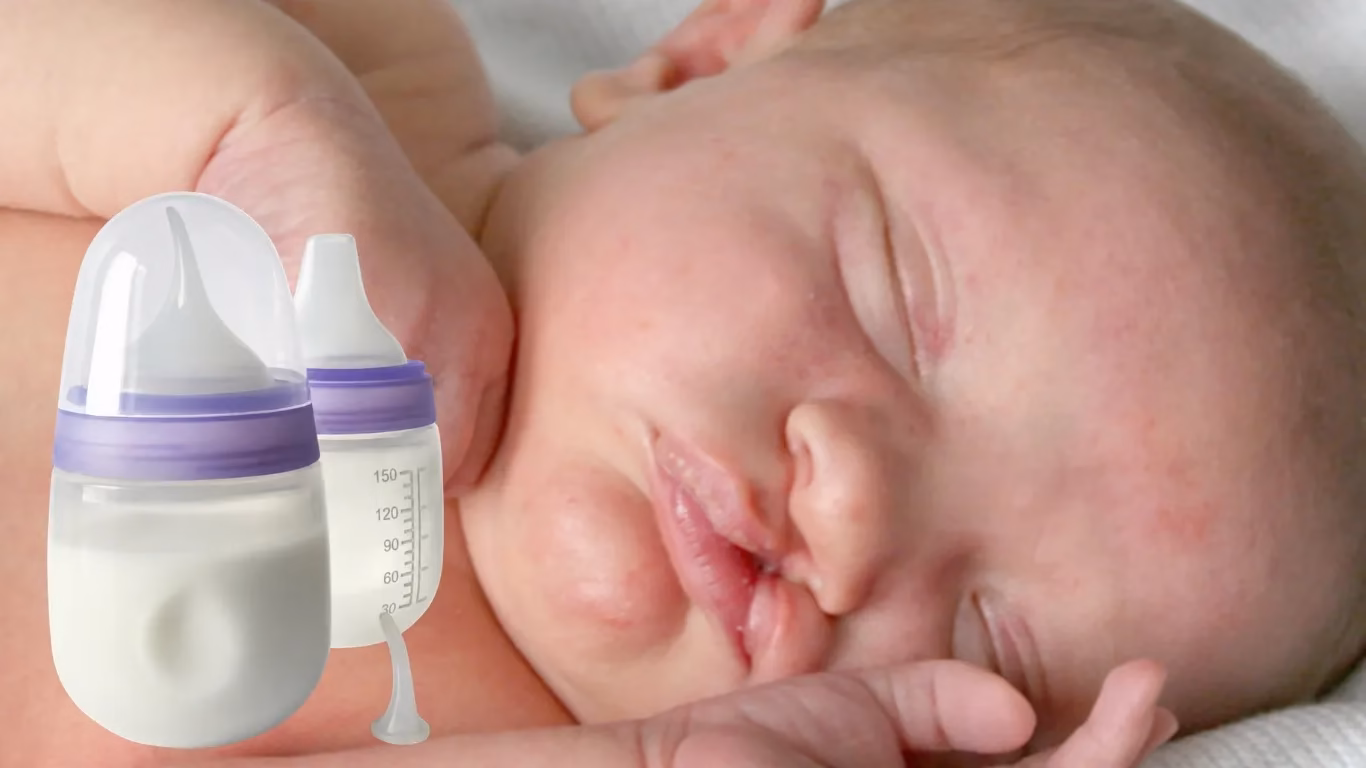 Boond Feeding Aid Offers Innovative Solution for Infants Born with Cleft Lip and Palate 1 NEET UG 30